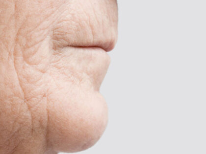 ways to reduce premature skin aging