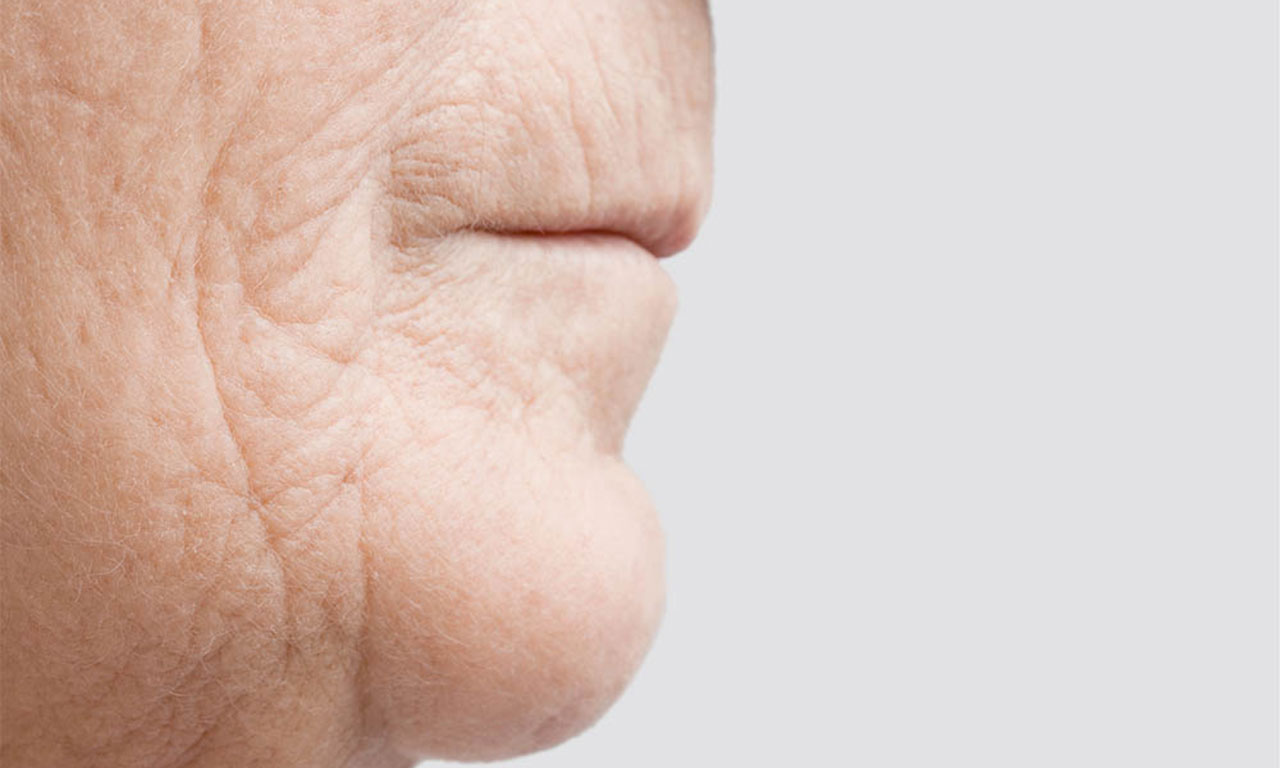 ways to reduce premature skin aging