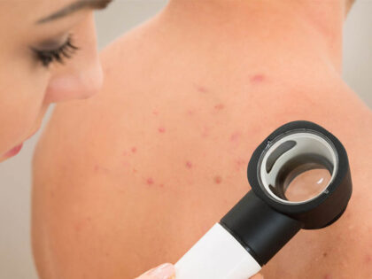 skin care for patients with diabetes